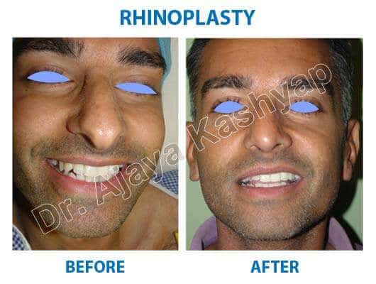 best plastic surgeon in india