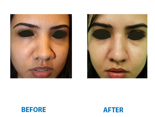 best facial plastic surgeon in india