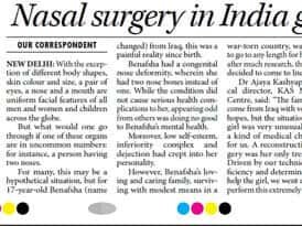 nasal surgery in india